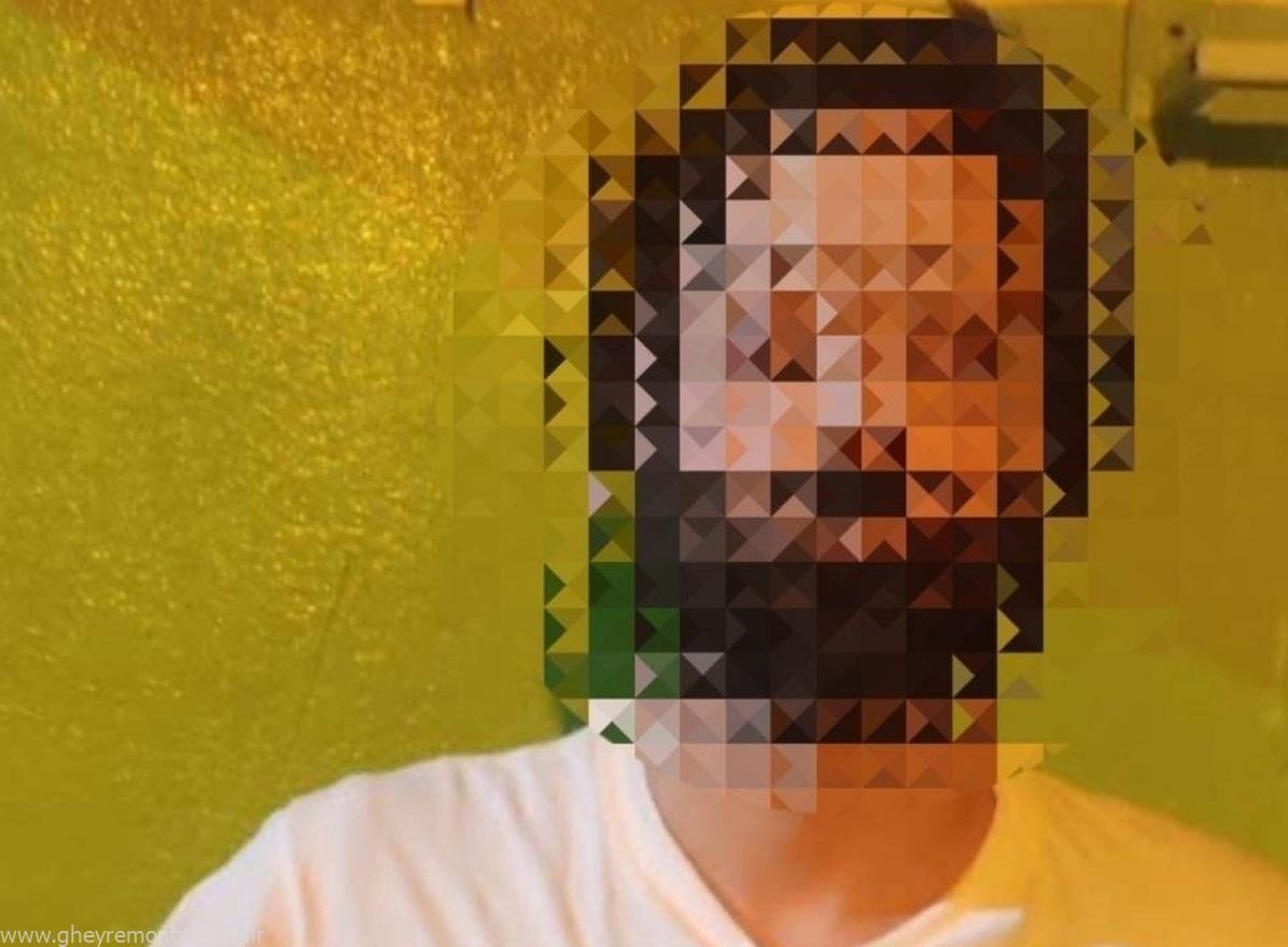 جزئیات ماجرای بریدن گوش دختر نوجوان در مازندران! / بازداشت فرد متخلف و تلاش برای پیوند عضو