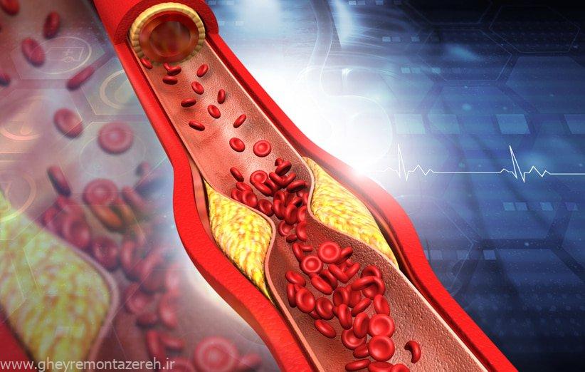 کاهش کلسترول خون با مصرف این سبزی