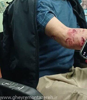 حمله پلنگ به یک جوان در اطاقور شهرستان لنگرود