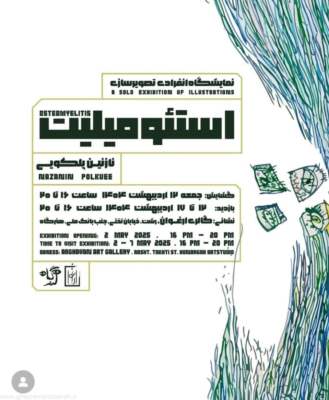 آغاز بکار نمایشگاه انفرادی تصویرسازی استئومیلیت نازنین پلکویی